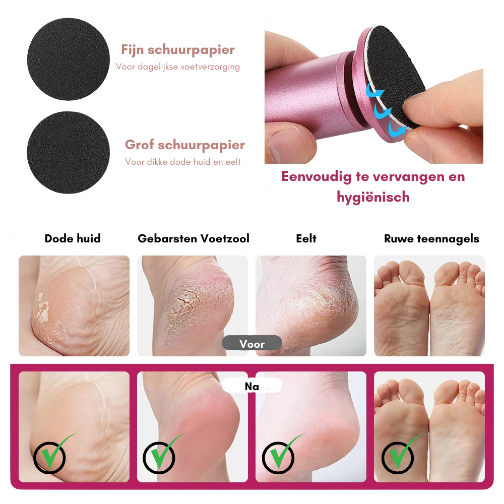 HeelGlow™ | Professionele Eeltverwijderaar